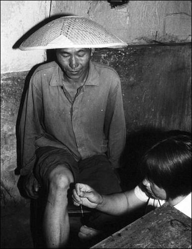 20111102-Wikicommons smoke barefoot doctor acupuncture.jpg